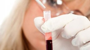 Железодефицитная анемия – причины, симптомы и лечение