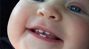 Что делать, когда у ребенка режутся зубки