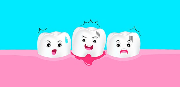 11 продуктов, которые вредят зубам и вызывают кариес