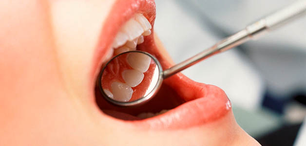 Как вылечить кисту зуба народными средствами 